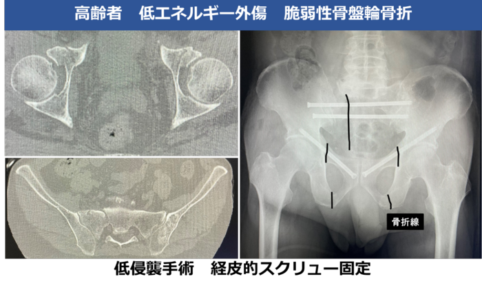 図③.png